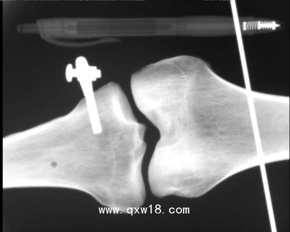 動物X射線機(jī)