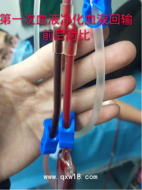 醫(yī)用臭氧治療儀便攜式三類臭氧機