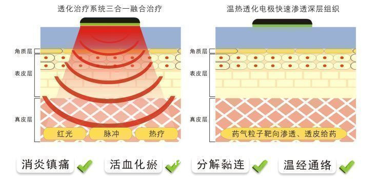 中頻理療儀 康復科甲類醫(yī)保新農(nóng)合100%報銷  觸摸屏操作