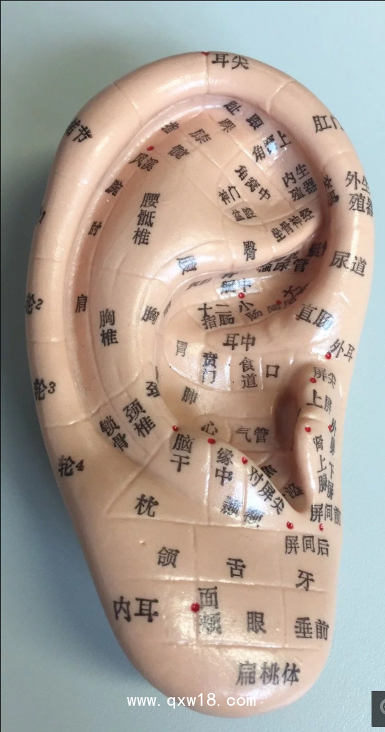 甄通暢王不留行籽耳穴貼