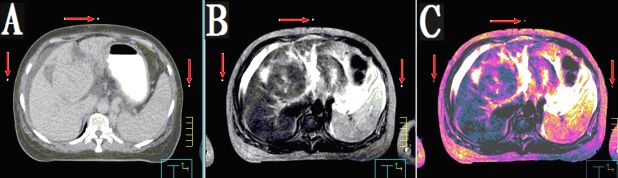 醫(yī)學(xué)圖像體外定位貼（MK⊙CT／MR）