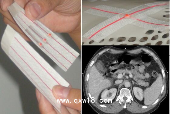 醫(yī)學(xué)圖像體外定位貼（MK-RT型，MK-CT型）