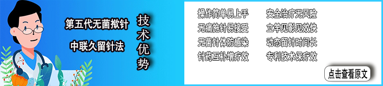 無菌電磁導(dǎo)電撳針