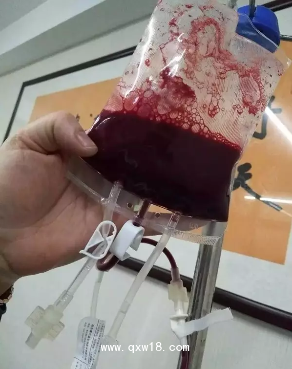 一次性大自血血袋，一次性輸血器，醫(yī)用臭氧儀等耗材產(chǎn)品批發(fā)