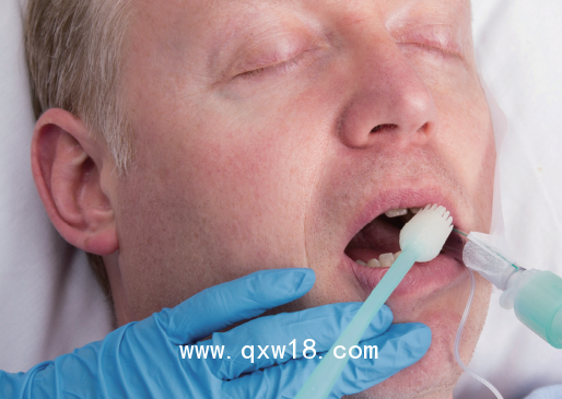 慧吉康沖吸式口護吸痰管