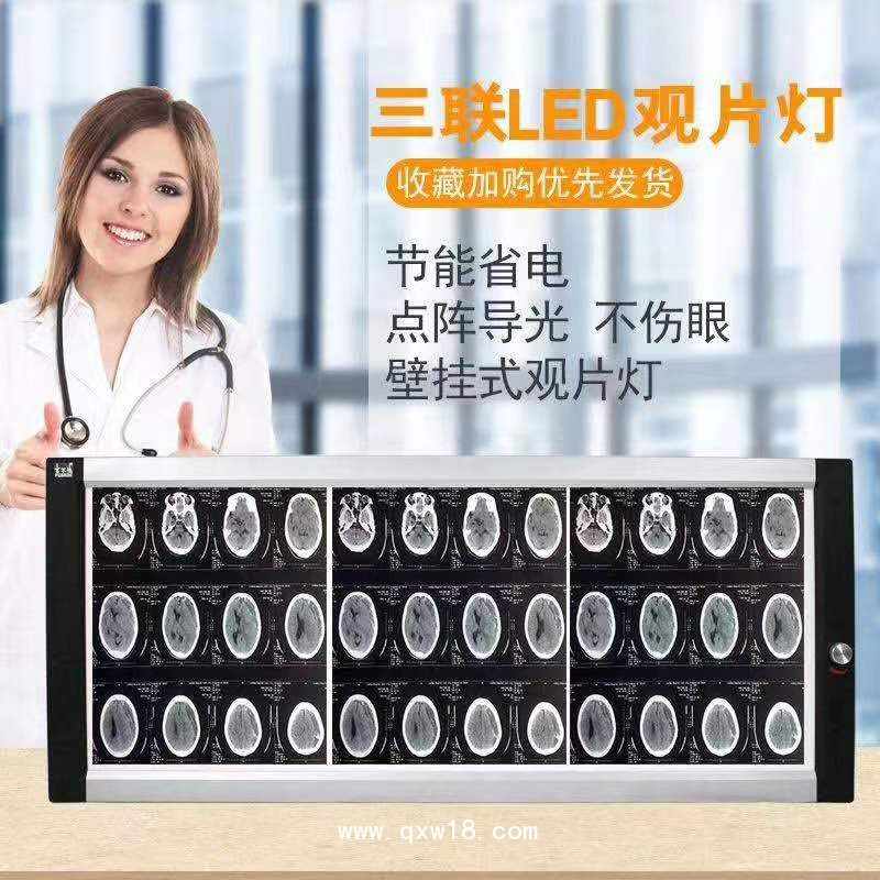 欣雨辰 YC-GP X射線膠片觀片燈 單聯(lián)/雙聯(lián)/三聯(lián)/四聯(lián)