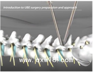 UBE雙通道脊柱微創(chuàng)手術(shù)系統(tǒng)