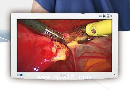 NDS醫(yī)療液晶監(jiān)視器