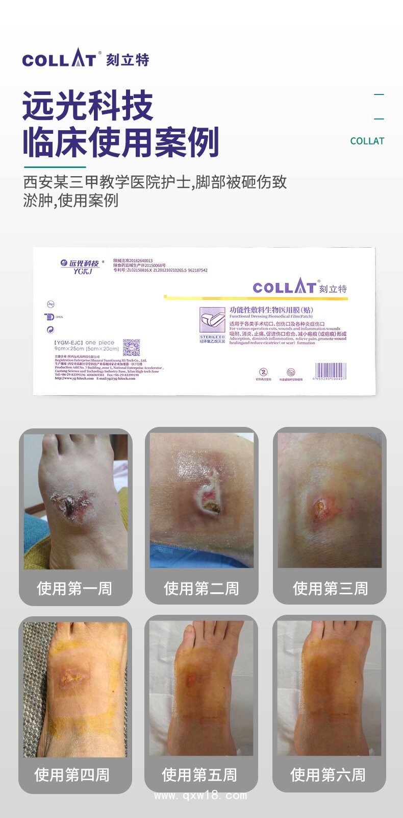 生物醫(yī)用復合材料---生物醫(yī)用膜（貼）----創(chuàng)口敷料