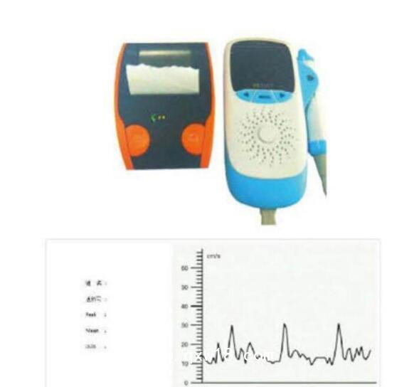原位超聲多普勒血流檢測(cè)儀 YW-100