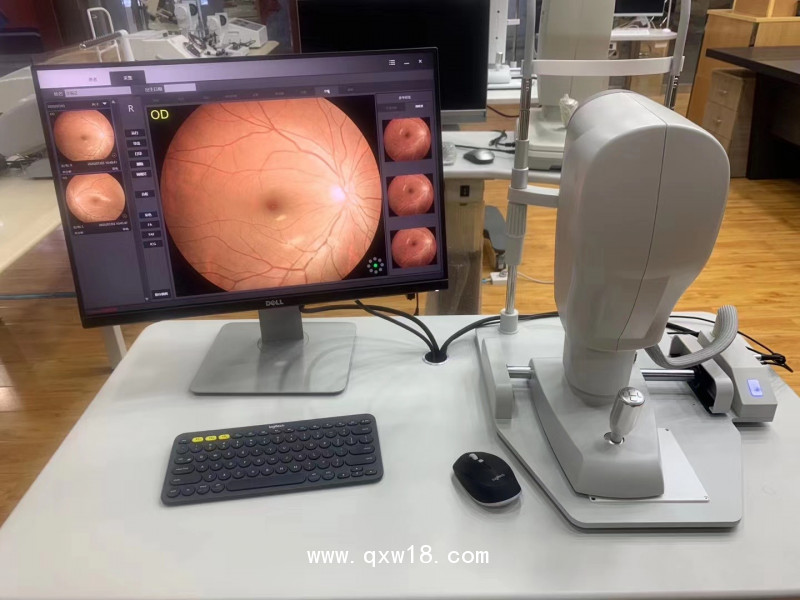 SW-8800免散瞳數碼眼底照相機