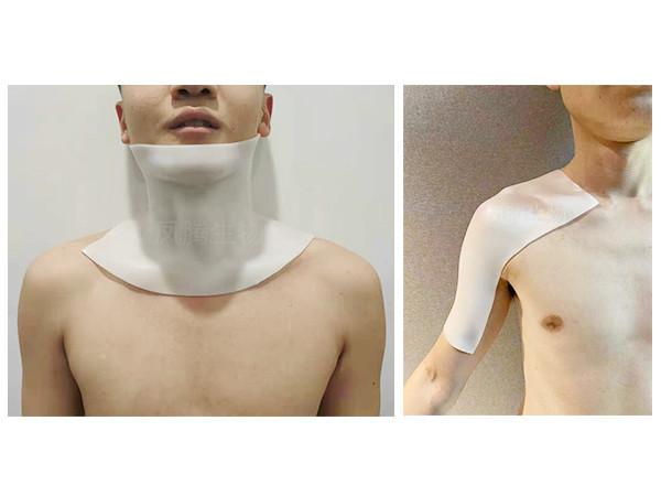 醫(yī)用外固定可塑性夾板(含硅酮凝膠)