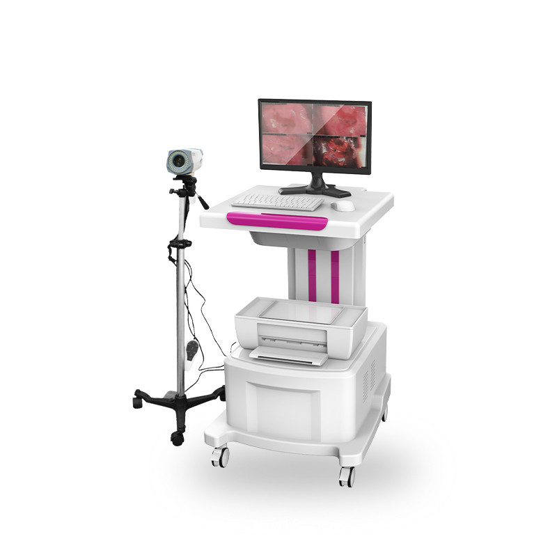 電子陰道鏡  電子陰道鏡廠家供應(yīng) 數(shù)碼電子陰道鏡