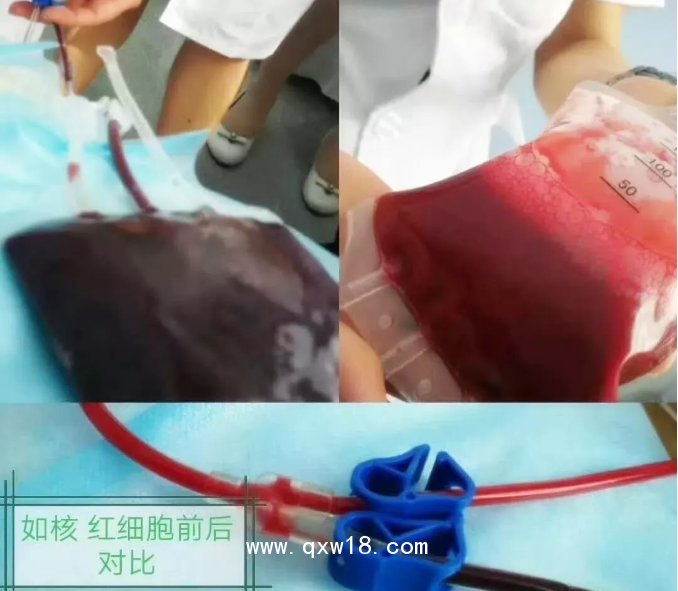 進(jìn)口醫(yī)用臭氧治療儀 國產(chǎn)醫(yī)用臭氧治療儀