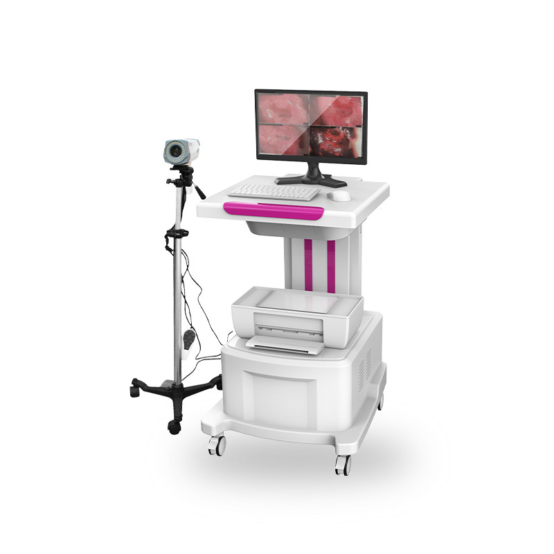 數(shù)碼電子陰道鏡 電子陰道鏡 陰道鏡