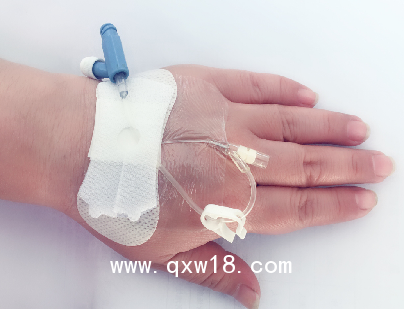 體表導管固定器