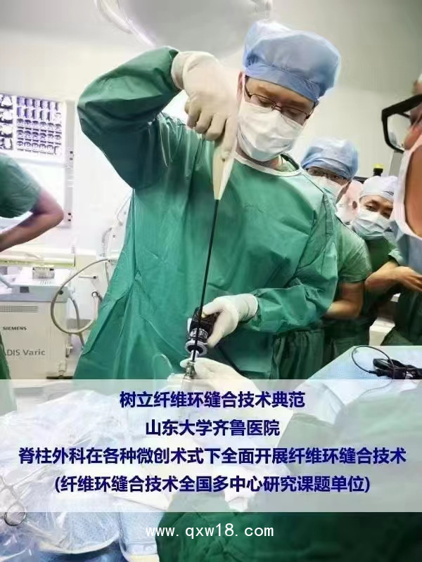 國(guó)產(chǎn)骨科高值耗材非帶量一次性纖維環(huán)縫合器