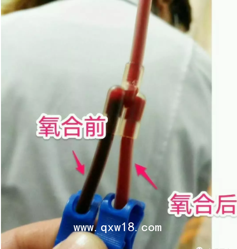 醫(yī)用臭氧治療儀國內(nèi)