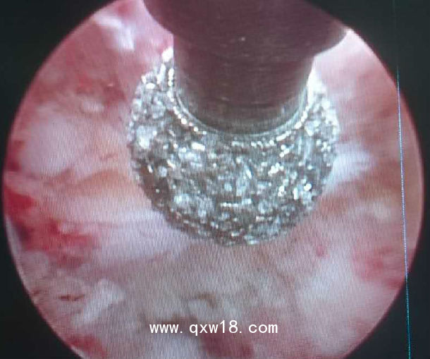 骨科動力系統(tǒng)設備出租試用