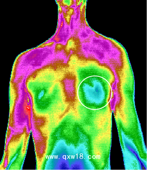 中醫(yī)熱CT/中醫(yī)智能診斷/紅外熱CT/紅外熱像儀/熱斷層