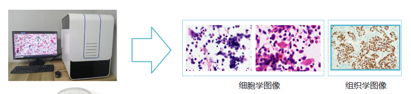 子宮內膜癌篩查細胞醫(yī)學圖像分析系統(tǒng)