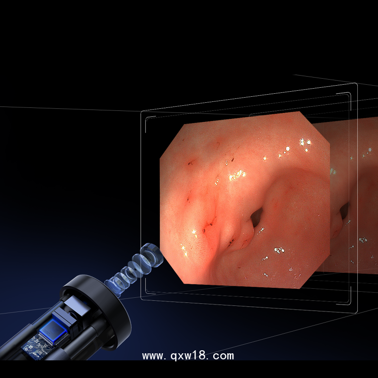 消化內(nèi)鏡 電子上消化道內(nèi)窺鏡HD-GT1