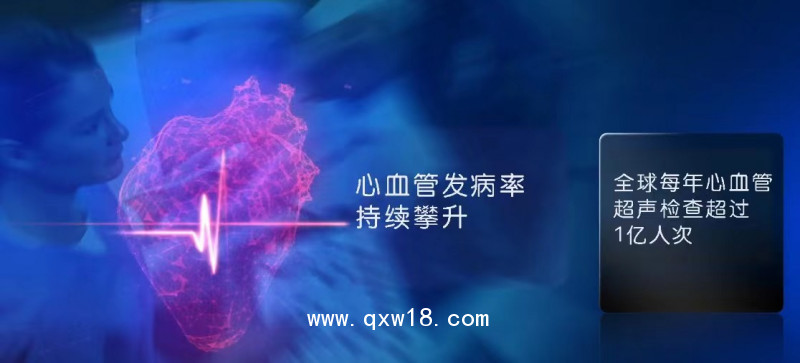 GE彩色多普勒超聲診斷儀B超儀器彩超設備四維彩超