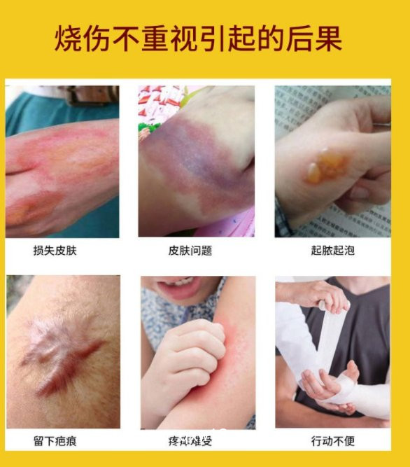 鼻炎膏凝膠定制定做貼牌代加工各種企業(yè)企業(yè)合作醫(yī)療私人定制