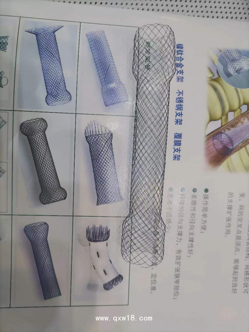 覆膜膽道支架、膽管