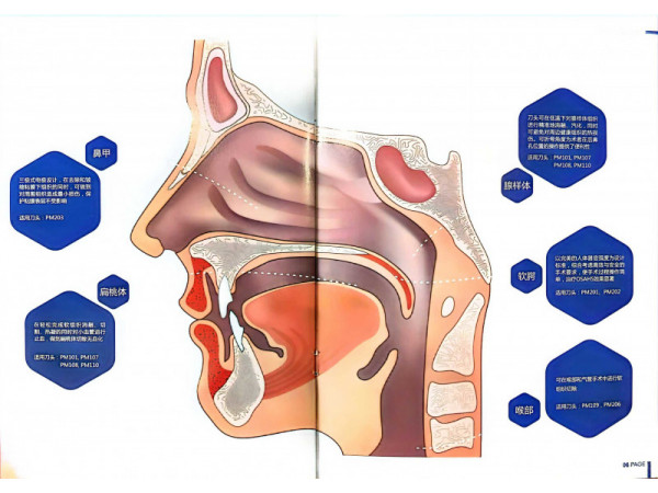 廣州帕瑪?shù)蜏氐入x子刀頭 帕瑪耳鼻喉刀頭 帕瑪關(guān)節(jié)等離子刀頭
