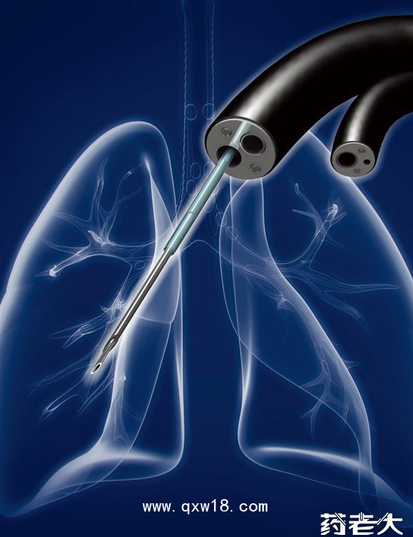 王氏TBNA活檢穿刺針細(xì)胞針