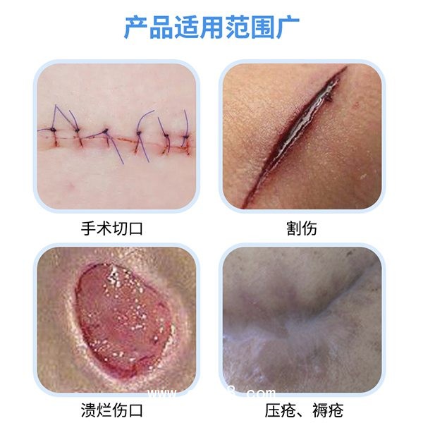 醫(yī)用無(wú)菌水膠體敷料