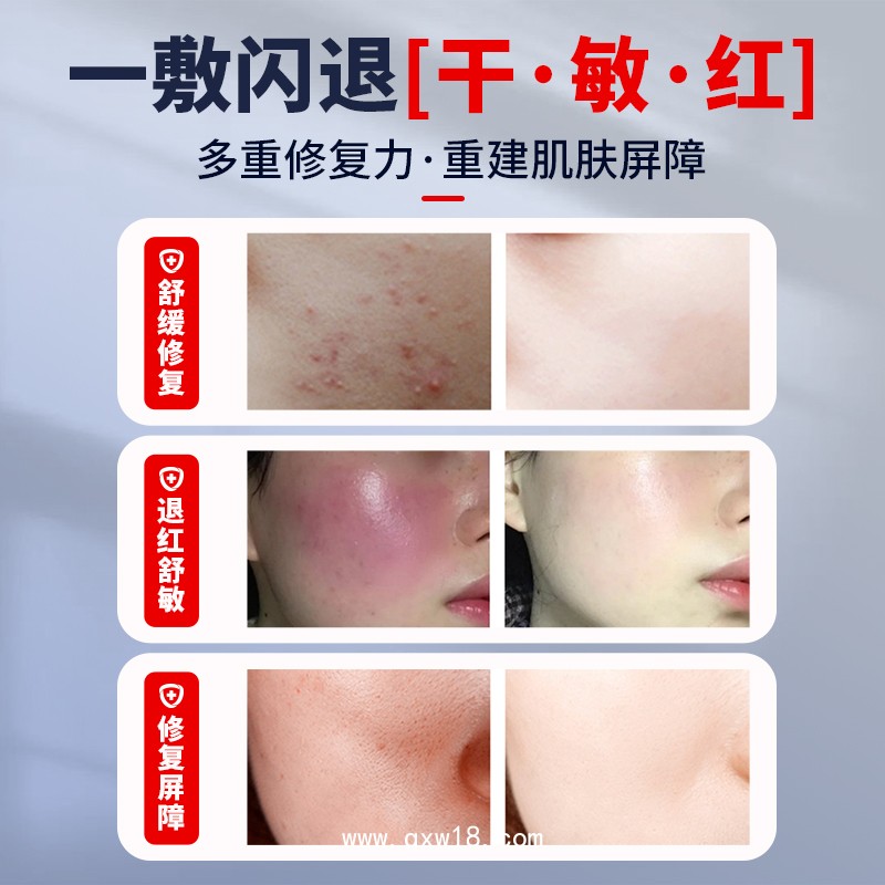 透明質(zhì)酸鈉敷料 二類械字號(hào)醫(yī)用面膜 美容院線專供