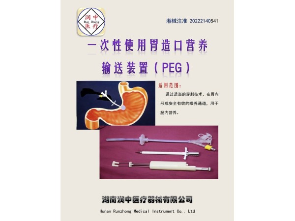 經(jīng)皮胃造瘺飼管（一次性使用胃造口營(yíng)養(yǎng)輸送裝置(PEG)）