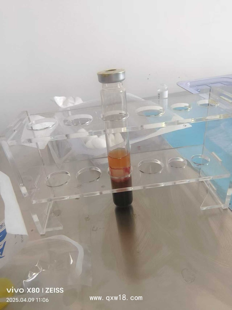 富血小板血漿制備套裝  富血小板血漿(PRP)制備器耗材