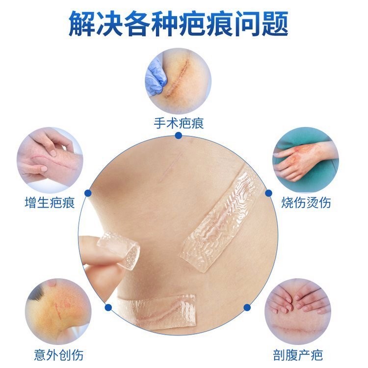 疤痕貼二類器械臨床掛網(wǎng)剖腹產(chǎn)疤痕新舊疤痕貼