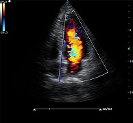 圖片關(guān)鍵詞