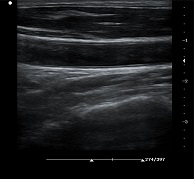 圖片關(guān)鍵詞