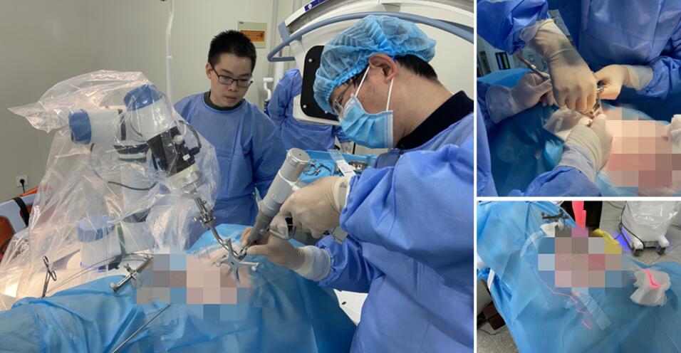 天權骨科手術機器人-手術微創(chuàng)化